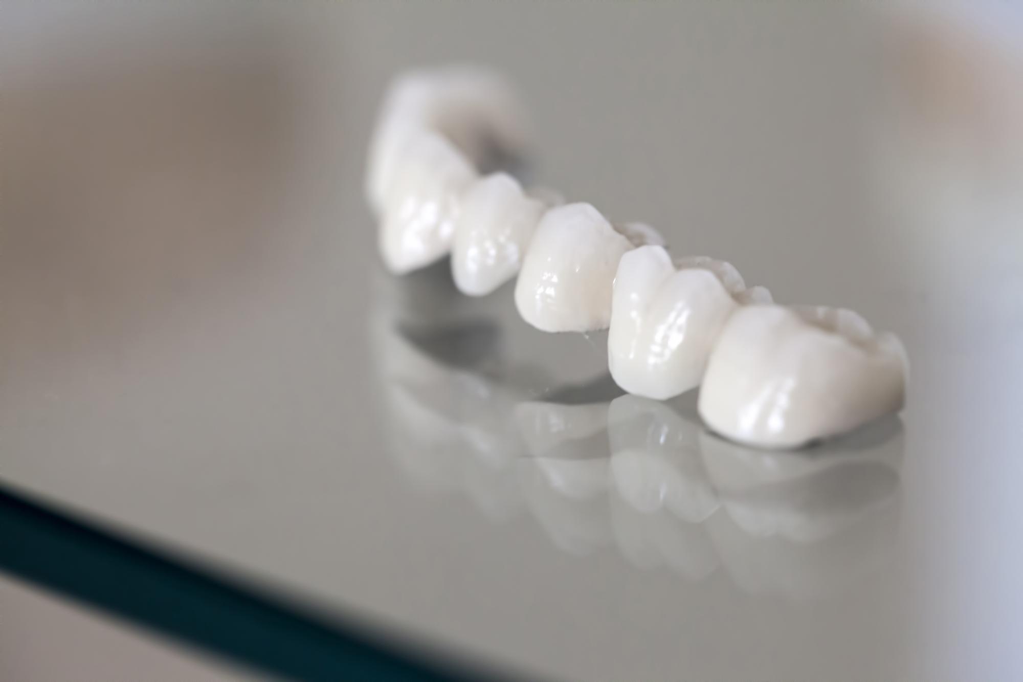 zirconium-porcelain-tooth-plate-dentist-store-photo_251006-4553