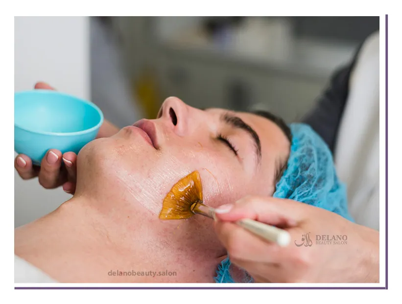 خدمات لایه برداری شیمیایی