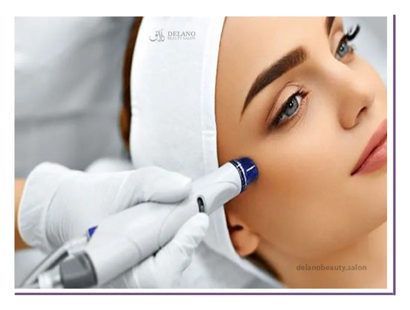 Microdermabrasion
