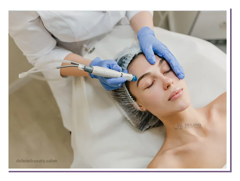 Microneedling