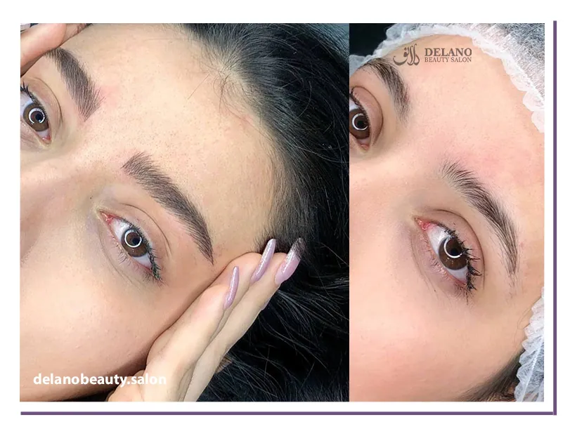 Benefits of microblading