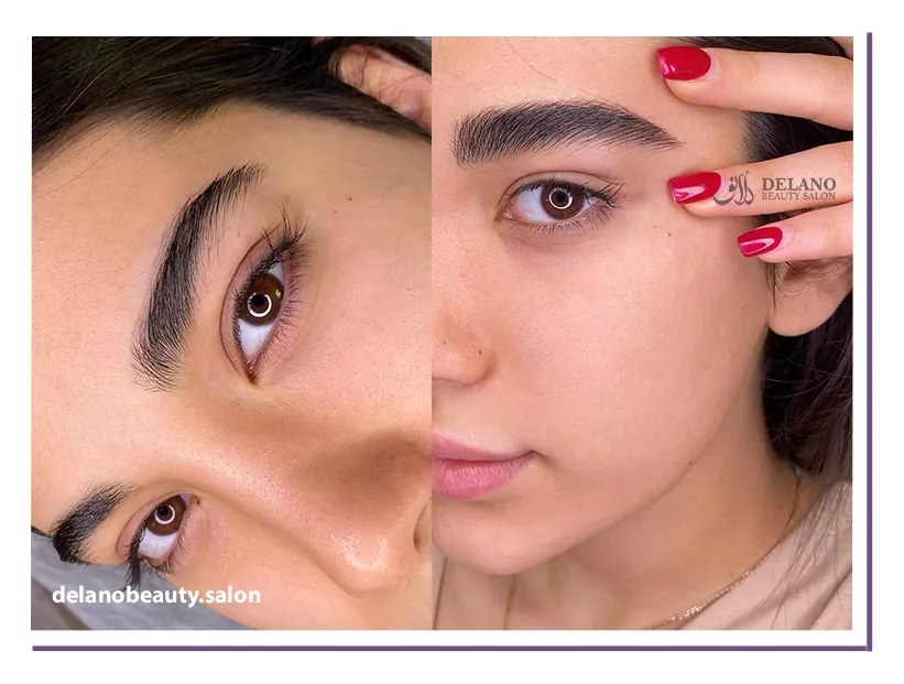 میکروبلیدینگ ابرو