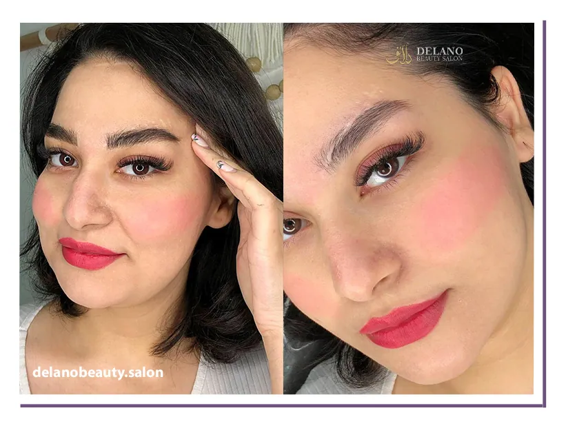 Side effects of microblading 1