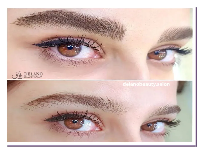 قیمت میکروبلیدینگ ابرو