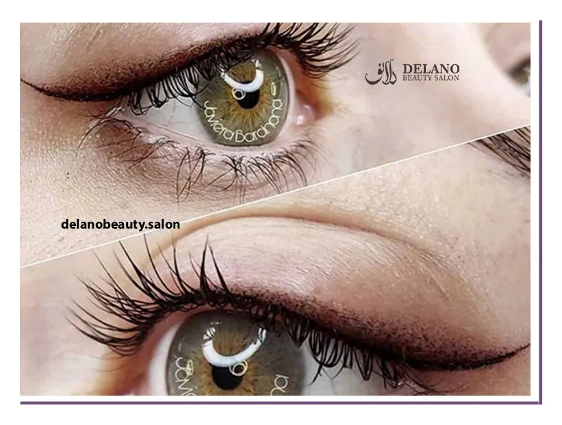 بن مژه یا خط چشم