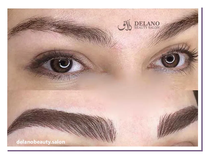 فیبروز ابرو