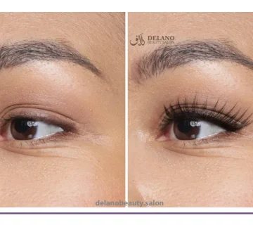 کاشت مژه دائم