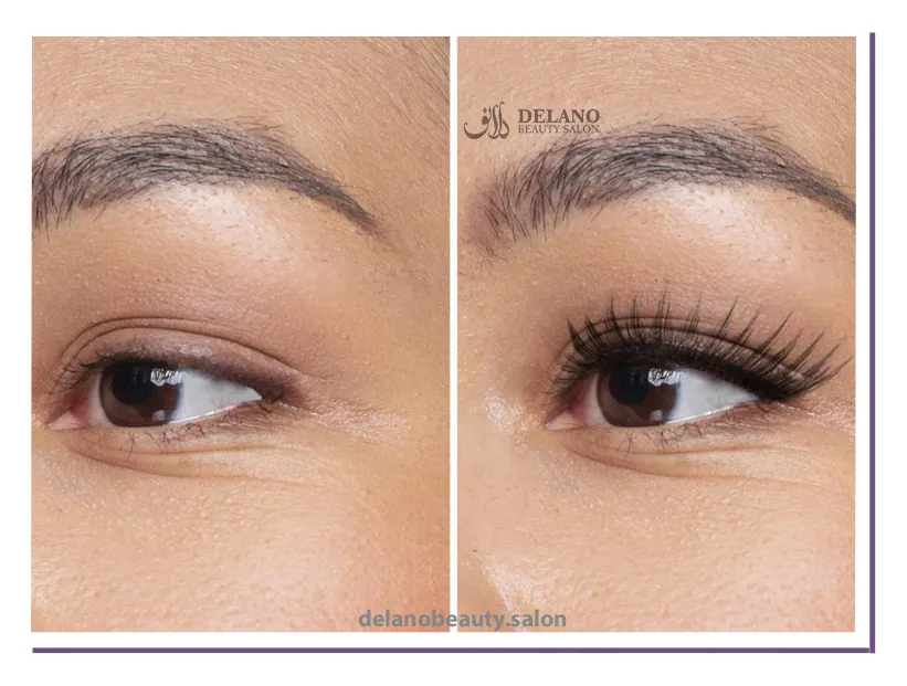 کاشت مژه دائم