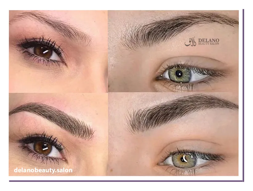 فرق فیبروز ابرو با میکروبلیدینگ