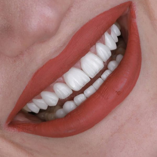smile