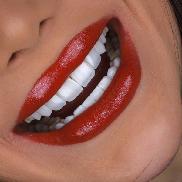smile