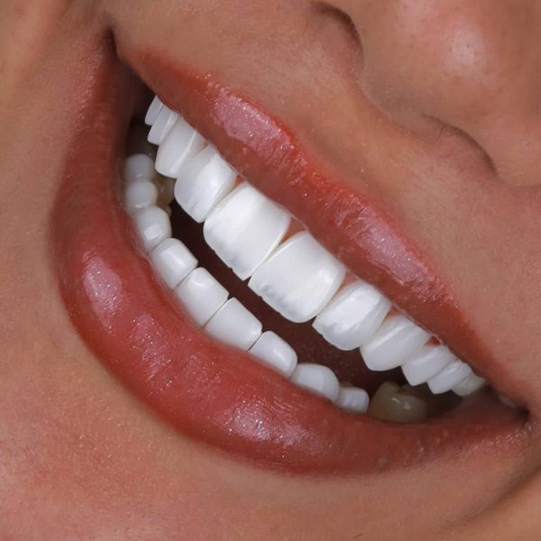 smile