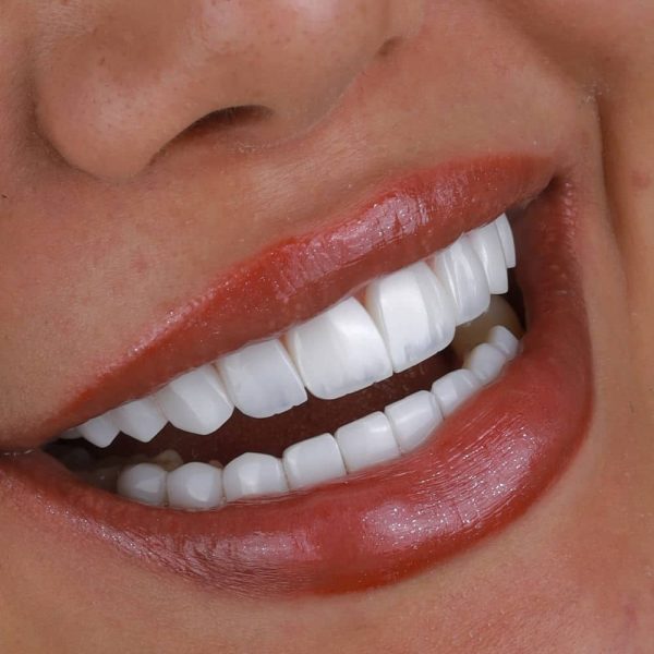 smile