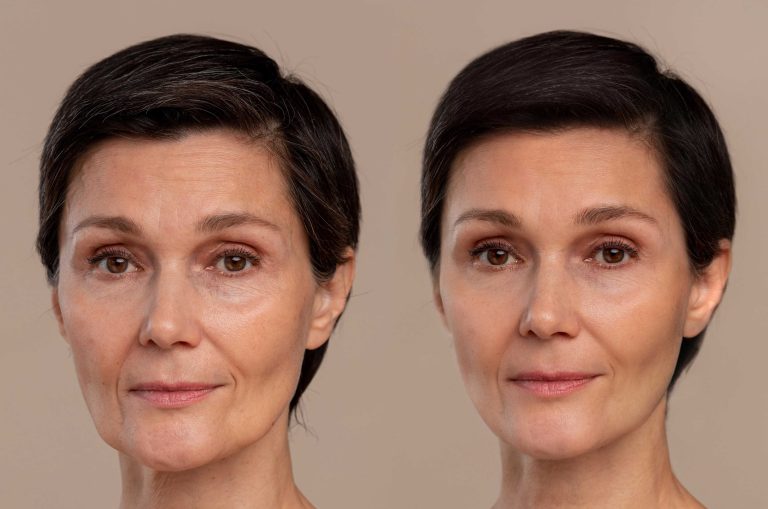 antiaging-beauty-treatment